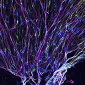 An immunofluorescence micrograph stained to show neurofilaments 