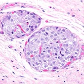 Transplanted islets